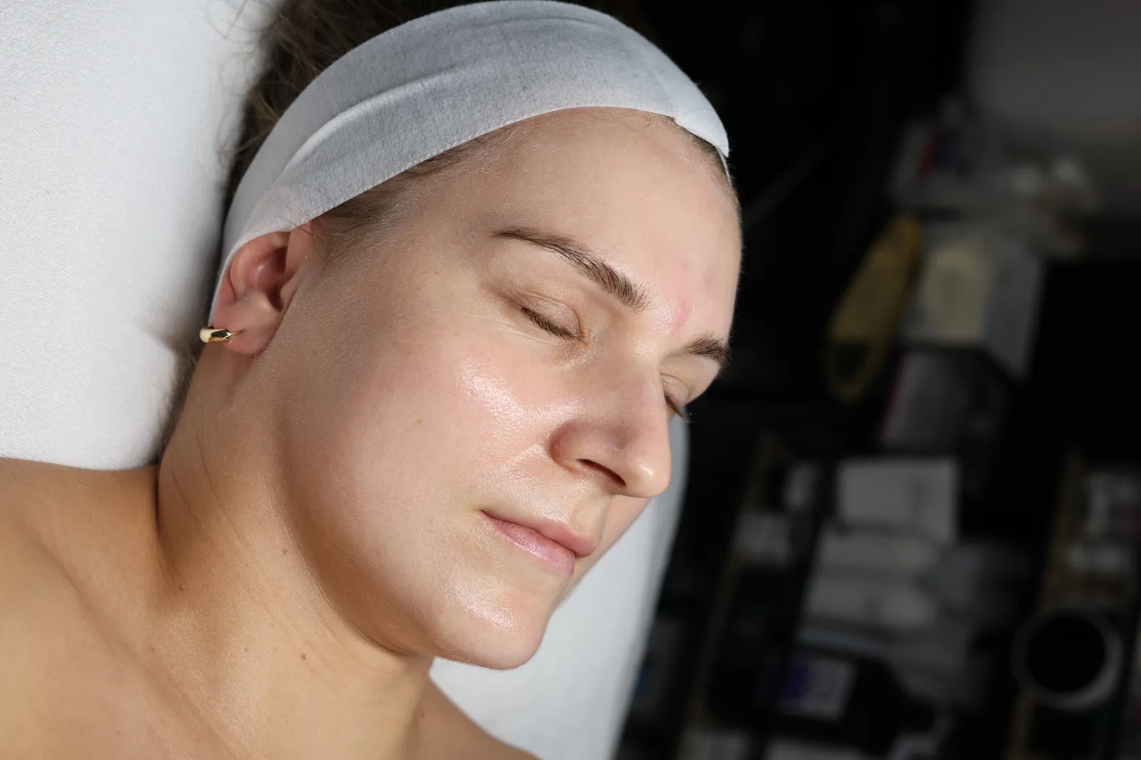 Treatments in Your 20s