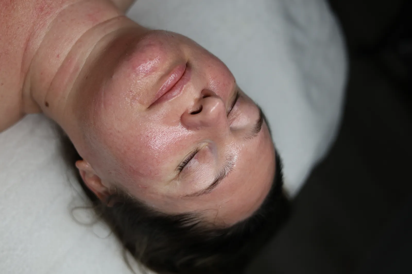 Treatments in Your 50s+