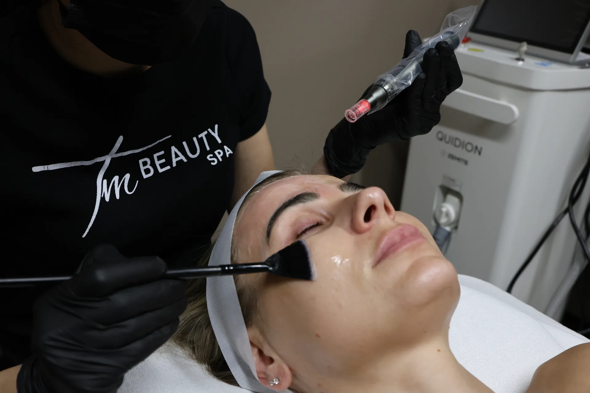Microneedling Face & neck * 4 treatments: Top master
